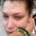 Bella Hadid Says She Suffers Excruciating Pain During Depressive Episodes